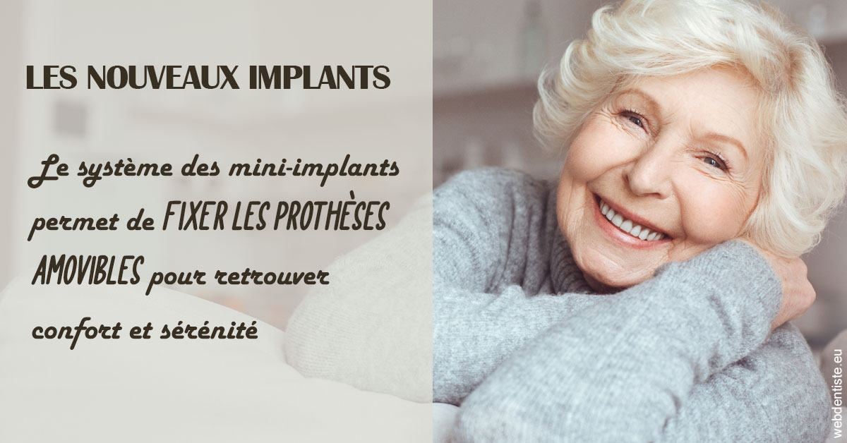 https://dr-prevot-pascal.chirurgiens-dentistes.fr/Les nouveaux implants 1