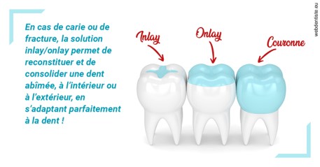 https://dr-prevot-pascal.chirurgiens-dentistes.fr/L'INLAY ou l'ONLAY