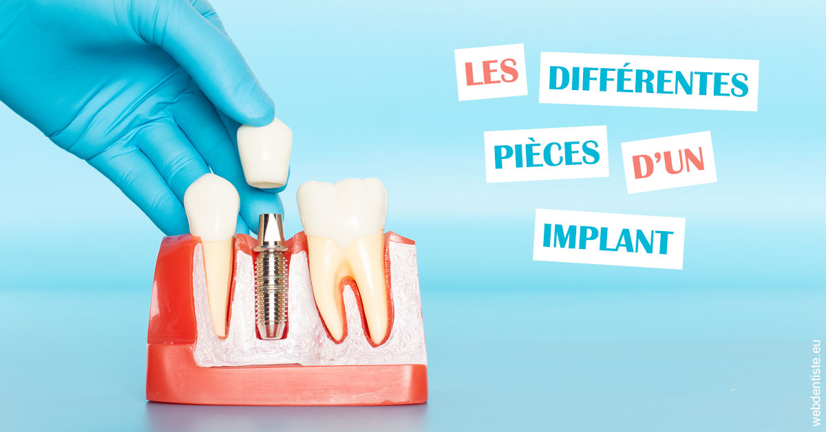 https://dr-prevot-pascal.chirurgiens-dentistes.fr/Les différentes pièces d’un implant 2