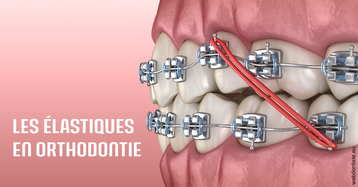 https://dr-prevot-pascal.chirurgiens-dentistes.fr/Elastiques orthodontie 2