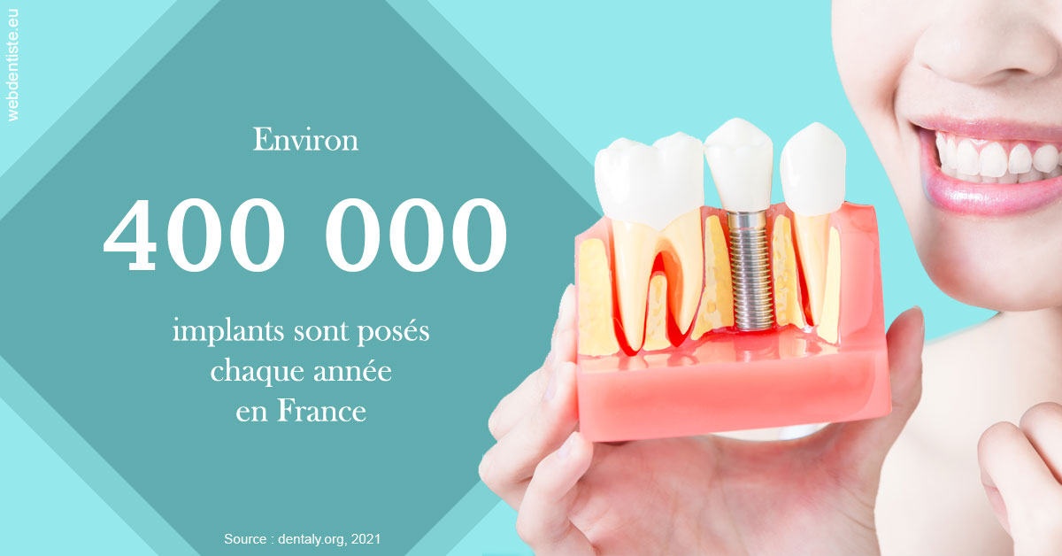 https://dr-prevot-pascal.chirurgiens-dentistes.fr/Pose d'implants en France 2