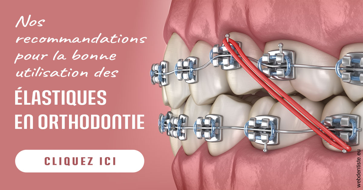 https://dr-prevot-pascal.chirurgiens-dentistes.fr/Elastiques orthodontie 2